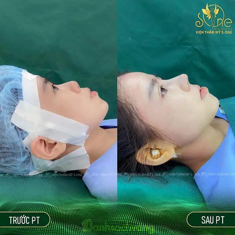 Hình ảnh Viện thẩm mỹ S-ONE: 412 Cao Thắng, Phường 12, Quận 10