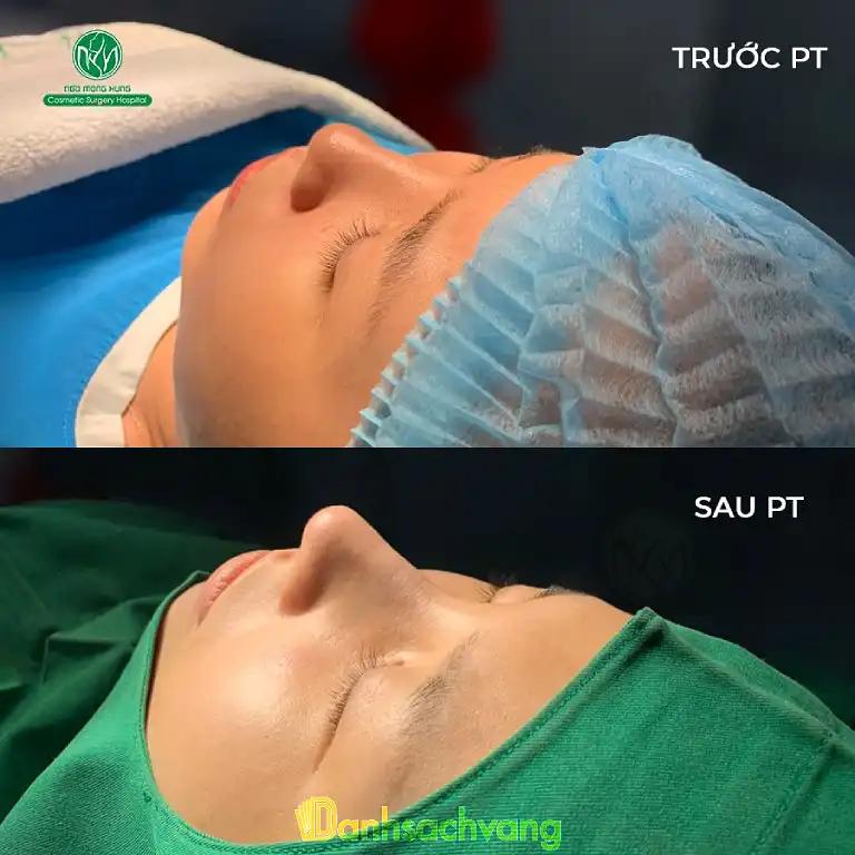 Hình ảnh Bệnh viện thẩm mỹ Ngô Mộng Hùng: 221 Nguyễn Đình Chiểu, Quận 3