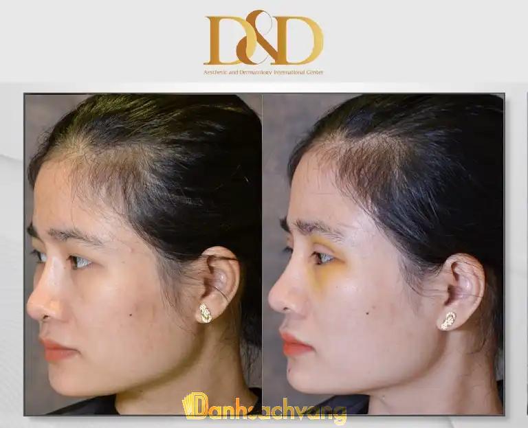 Hình ảnh Viện Thẩm Mỹ Quốc Tế D&D: 839/12 Lê Hồng Phong, Quận 10
