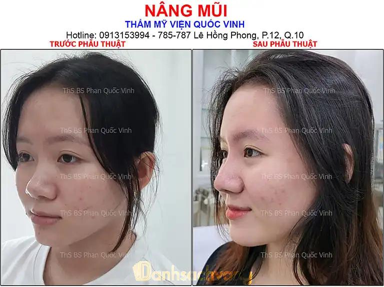 Hình ảnh Thẩm mỹ viện Quốc Vinh: 787 Lê Hồng Phong, Quận 10