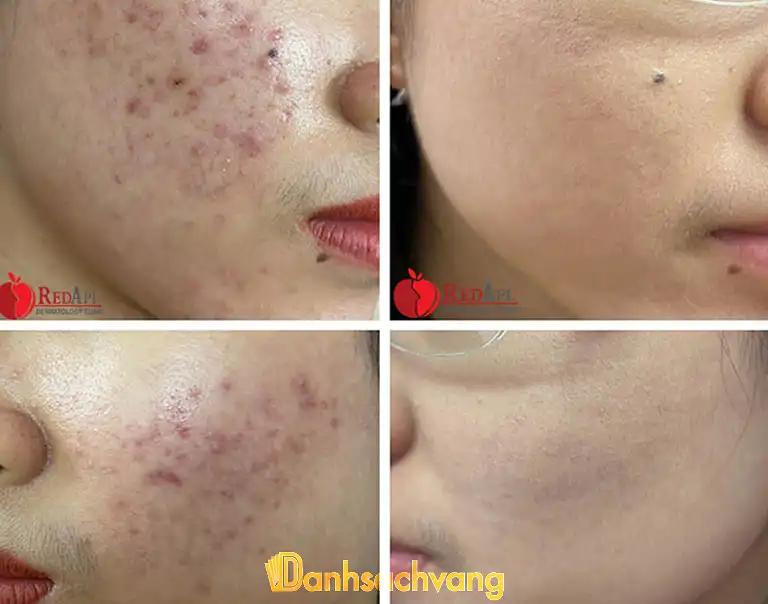 Hình ảnh Phòng khám chuyên khoa da liễu Táo Đỏ: 30/1A Ngô Thời Nhiệm, Quận 3