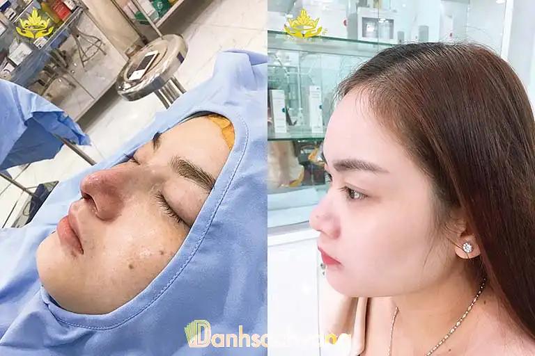 Hình ảnh Bác sĩ Lâm Bảo Cường: Chuyên khoa Phẫu thuật Tạo hình Thẩm Mỹ