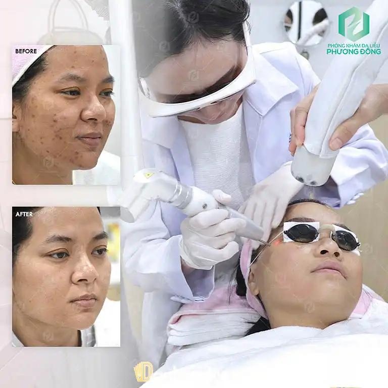 Hình ảnh Phòng khám da liễu PHƯƠNG ĐÔNG - 71 Thống Nhất Gò Vấp