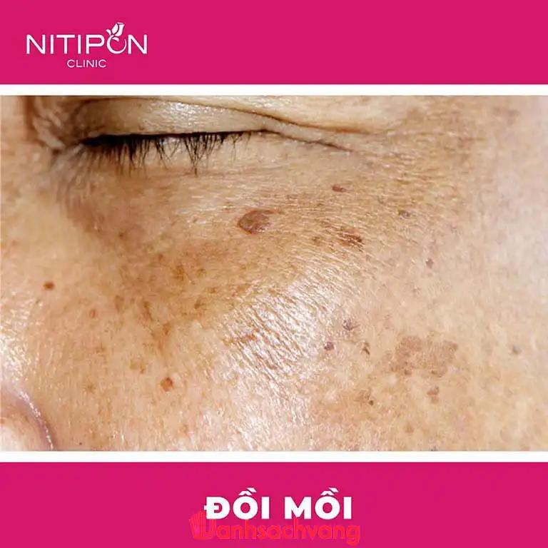 Hình ảnh Nitipon Clinic: 60 Mạc Thị Bưởi, Quận 1