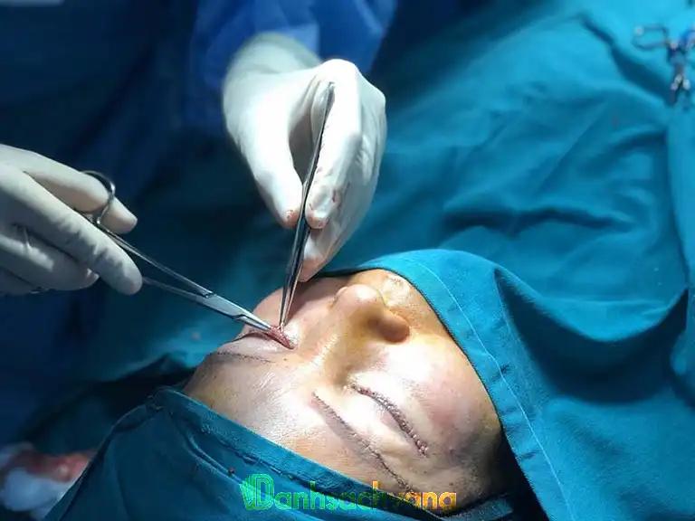 Hình ảnh 10 Địa chỉ phẫu thuật cắt mí mắt tại TPHCM đẹp, an toàn