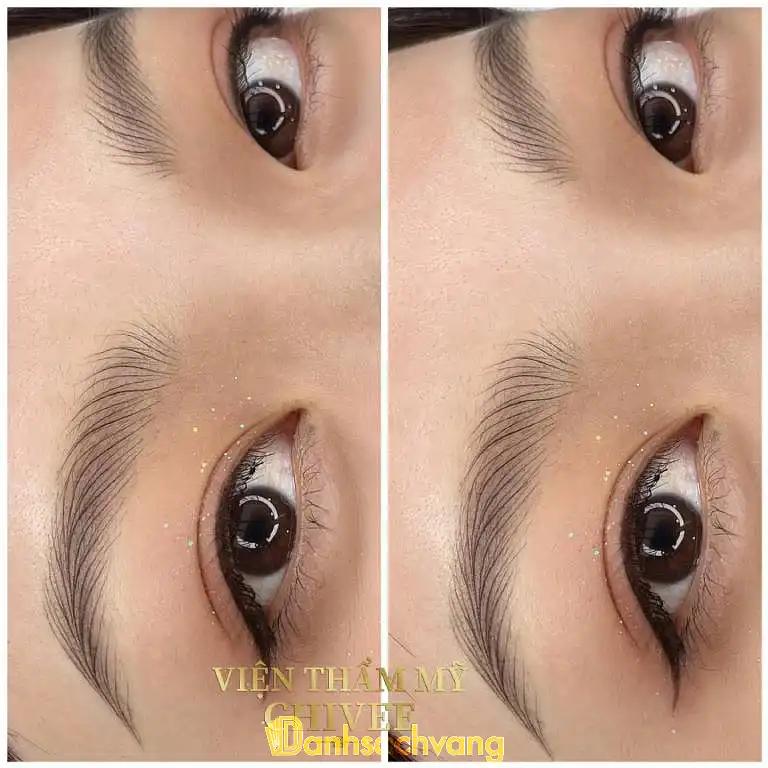 Hình ảnh Viện Thẩm Mỹ ChiVee: 423 Sư Vạn Hạnh, Quận 10