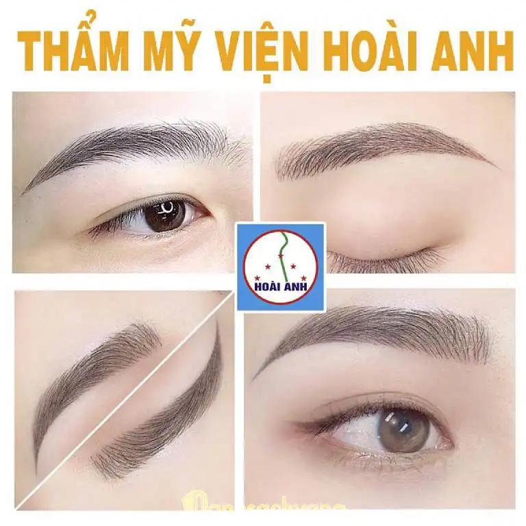 Hình ảnh Thẩm mỹ viện Hoài Anh: 237 Lý Thái Tổ, Quận 10