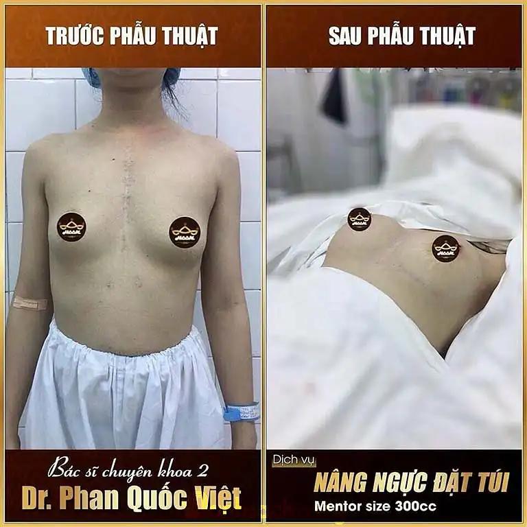 Hình ảnh Viện thẩm mỹ HANNAH: 68/282A Trần Quang Khải, Quận 1