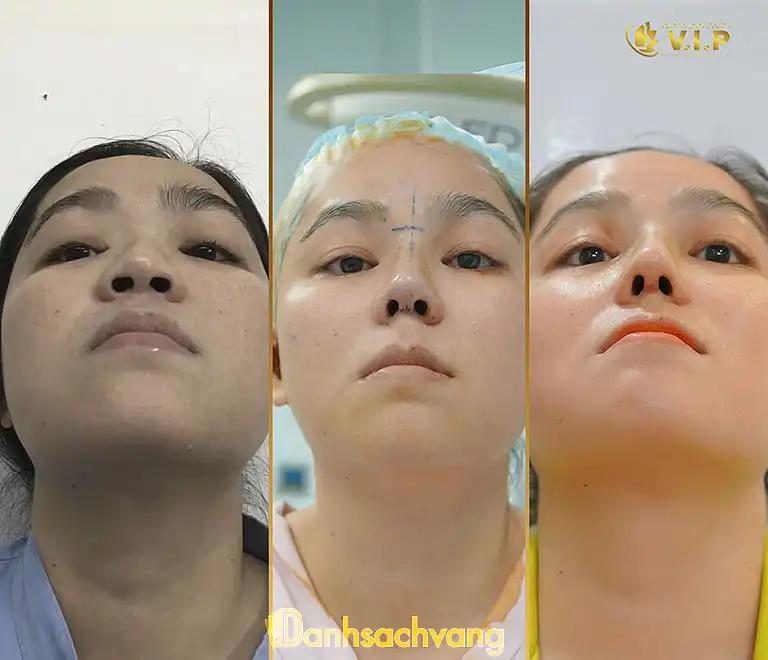 Hình ảnh Viện Thẩm Mỹ Quốc Tế VIP: 287A Nguyễn Trãi, Quận 1