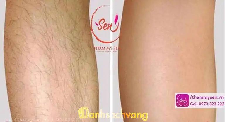 Hình ảnh Thẩm mỹ Sen: 285/20 Cách Mạng Tháng Tám, Quận 10