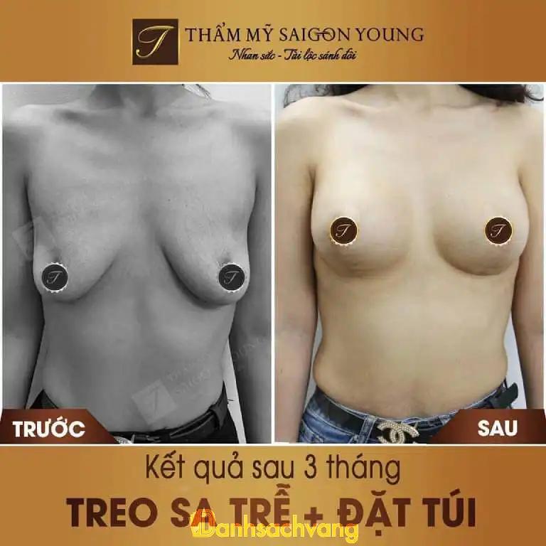 Hình ảnh Thẩm mỹ Saigon Young chi nhánh TPHCM