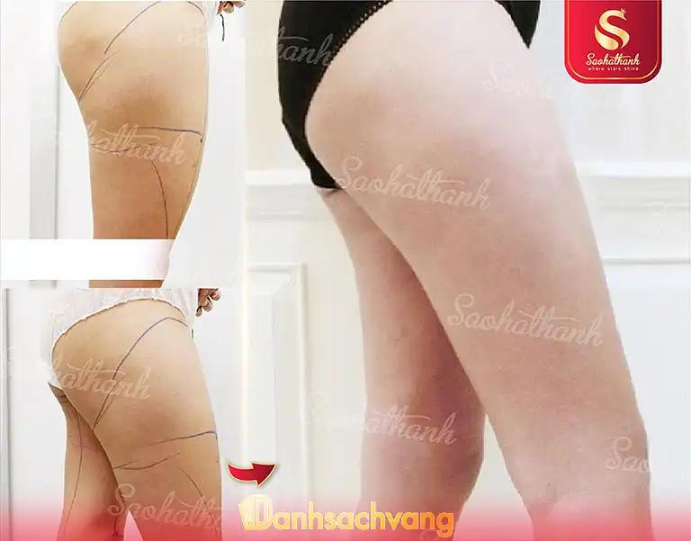 Hình ảnh Thẩm mỹ viện Sao Hà Thành chi nhánh Hà Nội