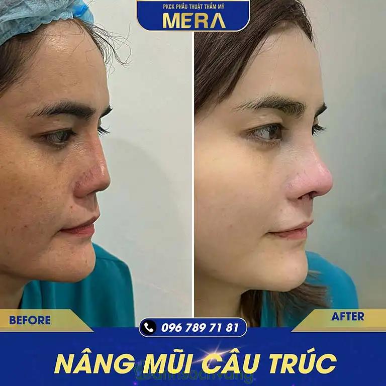 Hình ảnh Thẩm mỹ viện Mera: 75 Phạm Viết Chánh, Quận 1