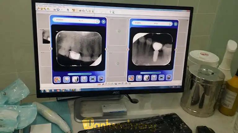 Hình ảnh Nha Khoa Kim: 101 Sương Nguyệt Ánh, Quận 1