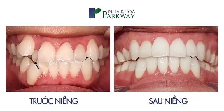 Hình ảnh Nha khoa Parkway: 413B Lê Văn Việt, Tp Thủ Đức