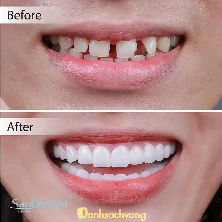 Hình ảnh san-dentist-phan-dinh-phung-q-phu-nhuan-tphcm-3