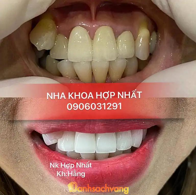 Hình ảnh nha-khoa-hop-nhat-phuoc-long-b-quan-9-tphcm-2