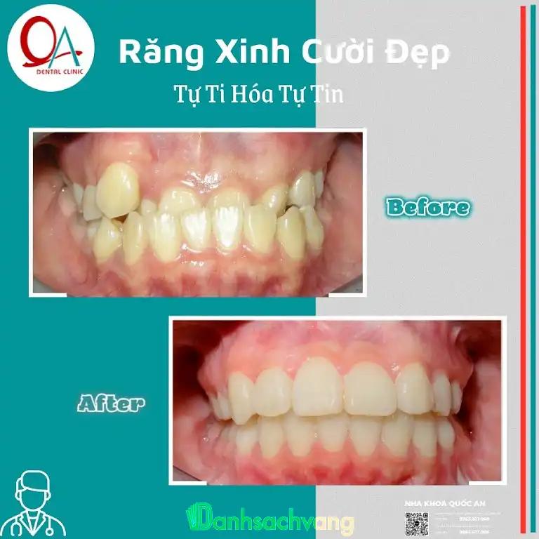 Hình ảnh Nha khoa Quốc An: 258 Ba Tháng Hai, Quận 10