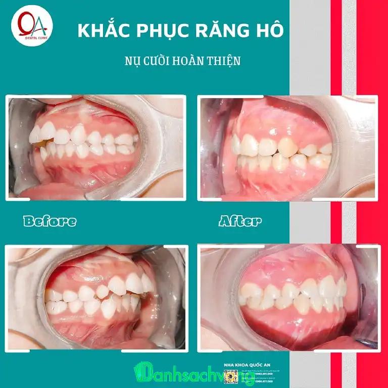 Hình ảnh Nha khoa Quốc An: 258 Ba Tháng Hai, Quận 10