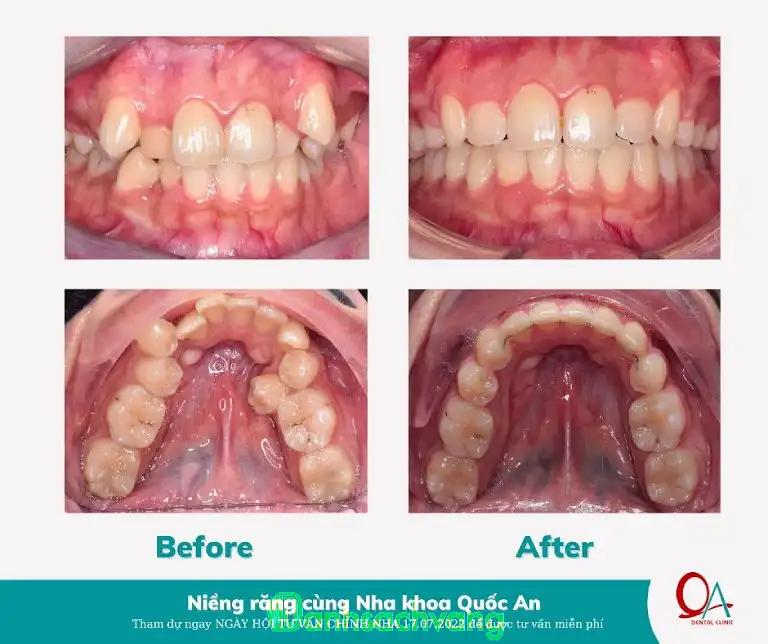 Hình ảnh Nha khoa Quốc An: 862A Tạ Quang Bửu, Quận 8