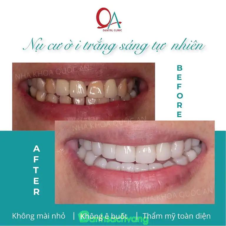 Hình ảnh Nha khoa Quốc An: 862A Tạ Quang Bửu, Quận 8