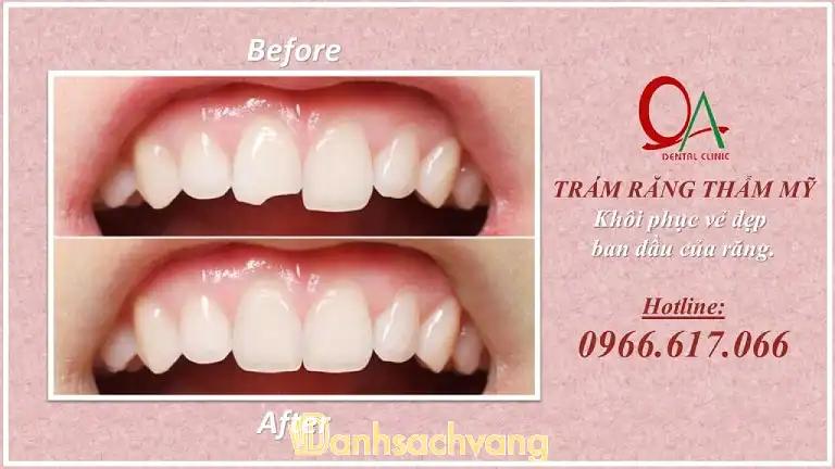 Hình ảnh Nha khoa Quốc An: 862A Tạ Quang Bửu, Quận 8