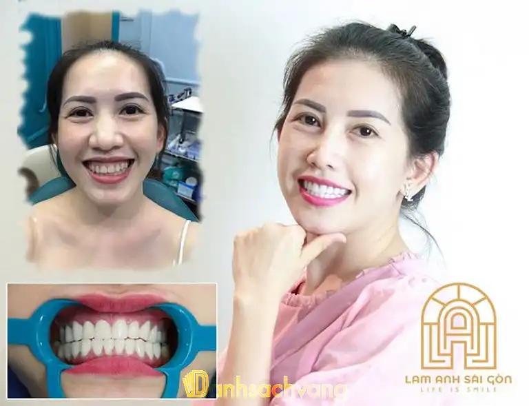 Hình ảnh nha-khoa-lam-anh-sai-gon-1