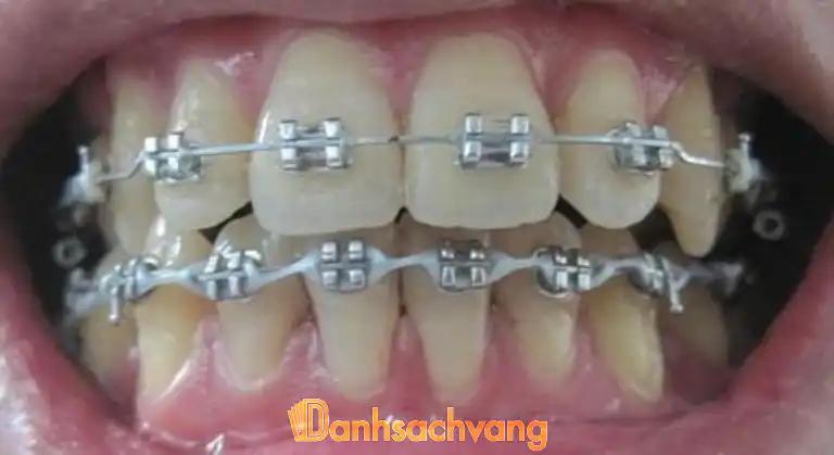 Hình ảnh Nha Khoa Toàn Cầu: 228 Hòa Hảo, Quận 10