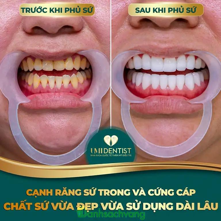 Hình ảnh Nha khoa UMI Dentist: 58 Đường 3 tháng 2, Quận 10