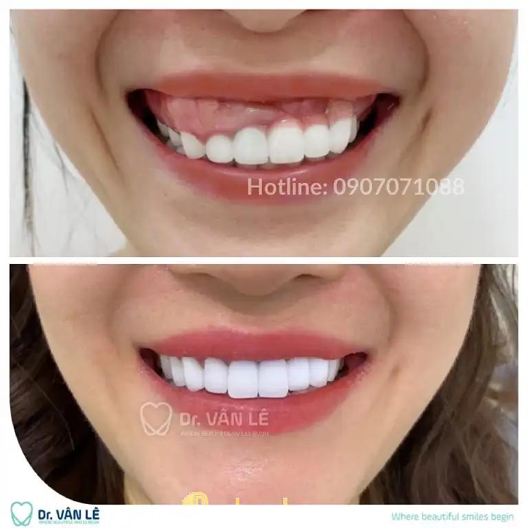Hình ảnh Nha khoa Cát Trắng: 762 Điện Biên Phủ, Quận 10