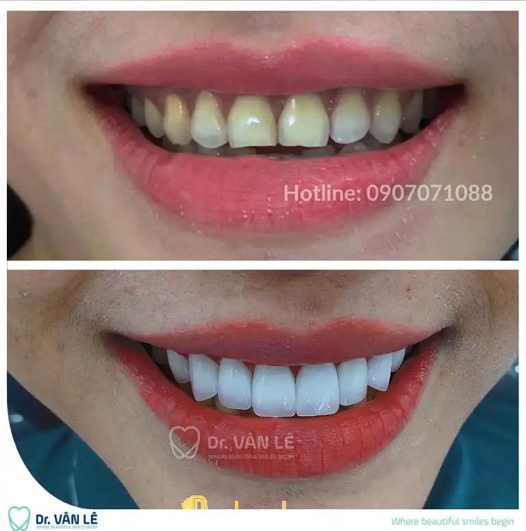 Hình ảnh Nha khoa Cát Trắng: 762 Điện Biên Phủ, Quận 10