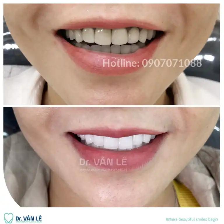 Hình ảnh Nha khoa Cát Trắng: 762 Điện Biên Phủ, Quận 10