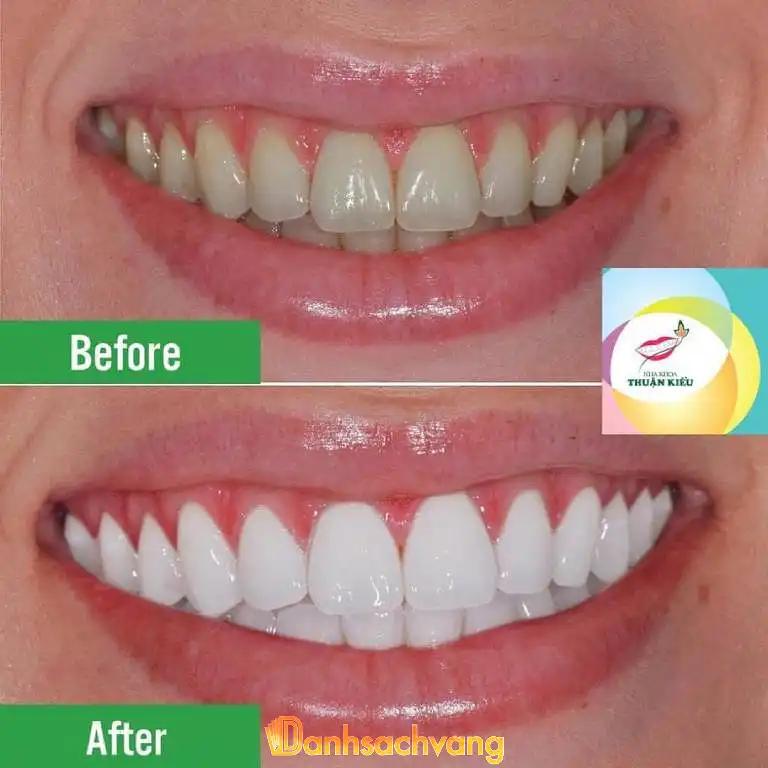 Hình ảnh Nha Khoa Thuận Kiều: 463A Hồng Bàng, Quận 5