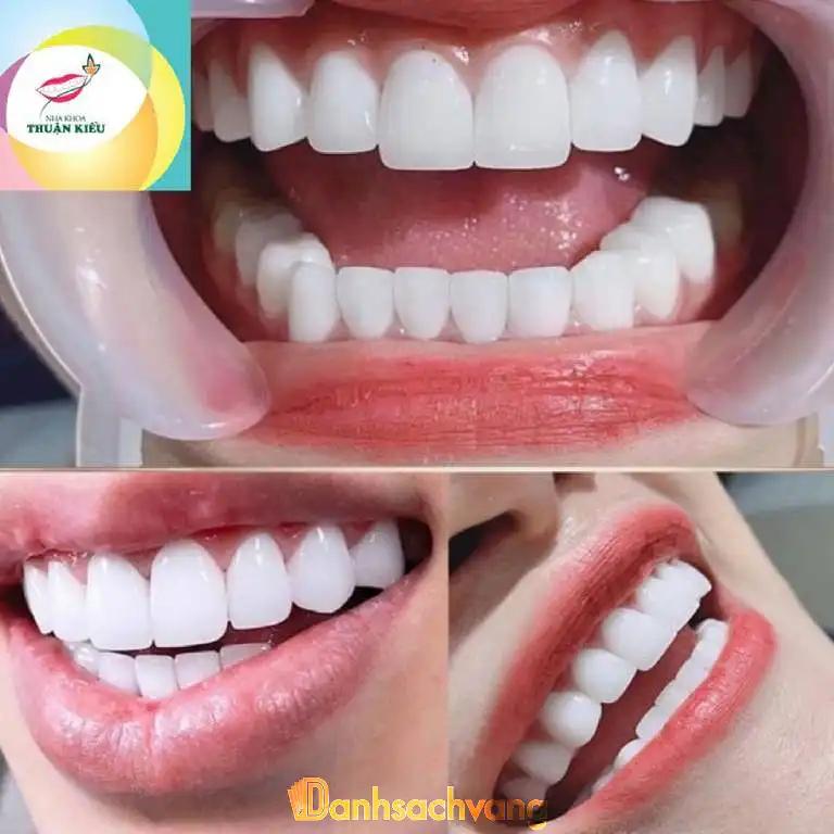 Hình ảnh Nha Khoa Thuận Kiều: 463A Hồng Bàng, Quận 5