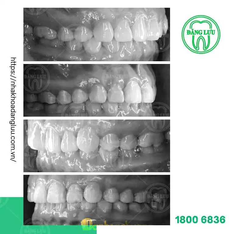 Hình ảnh Nha khoa Đăng Lưu cn Quận 5: 536 Trần Hưng Đạo, Phường 2