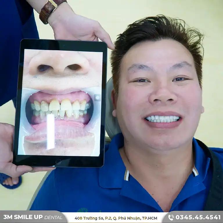 Hình ảnh nha-khoa-3m-smile-up-dental-care-5