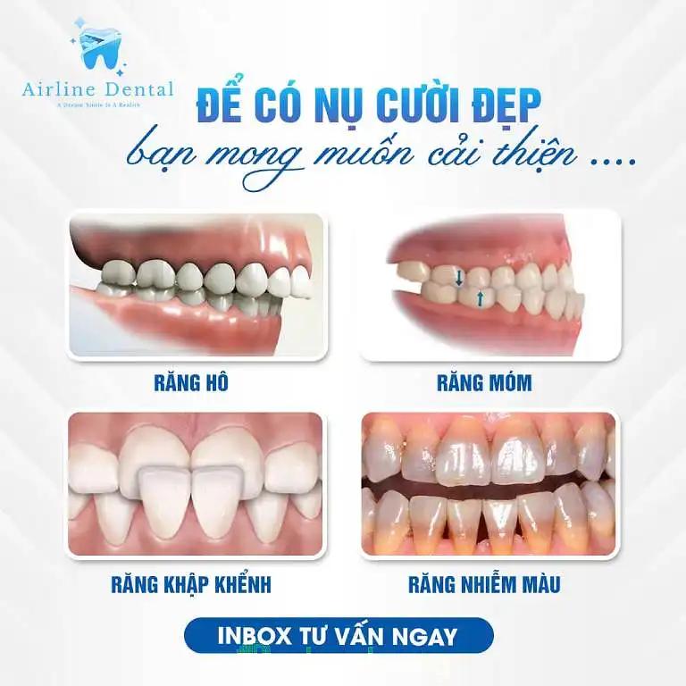 Hình ảnh Airline Dental: 7 Trần Hưng Đạo, Quận 5
