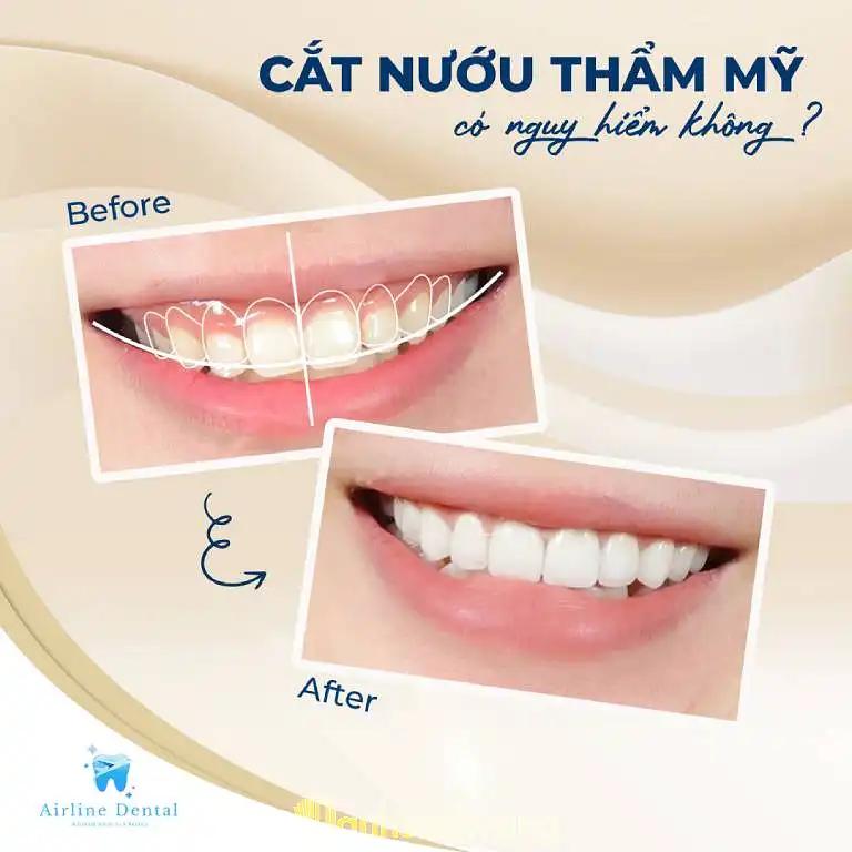 Hình ảnh Airline Dental: 7 Trần Hưng Đạo, Quận 5