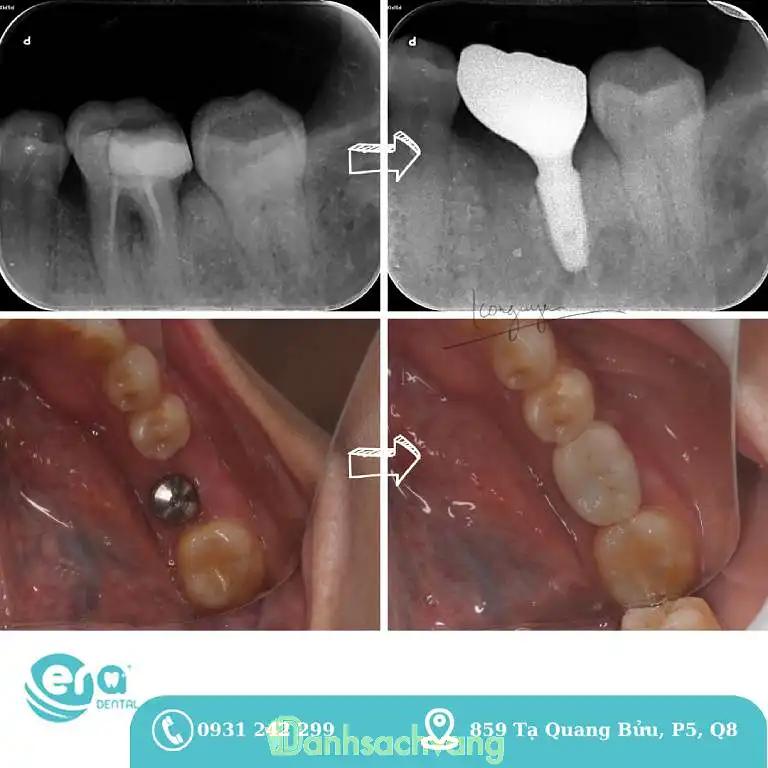 Hình ảnh Nha khoa ERA: 859 Tạ Quang Bửu, Quận 8