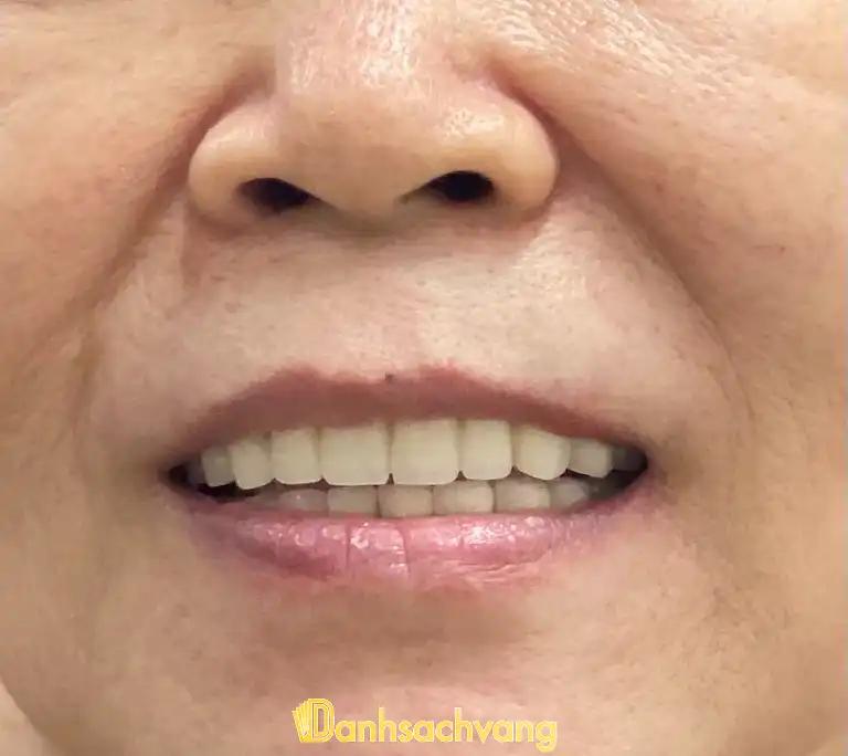 Hình ảnh nha-khoa-hanh-phuc-nguyen-van-luong-quan-6-tphcm-33