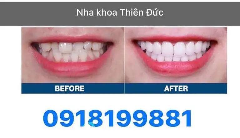 Hình ảnh nha-khoa-thien-duc-duong-so-1-quan-7-tphcm-1