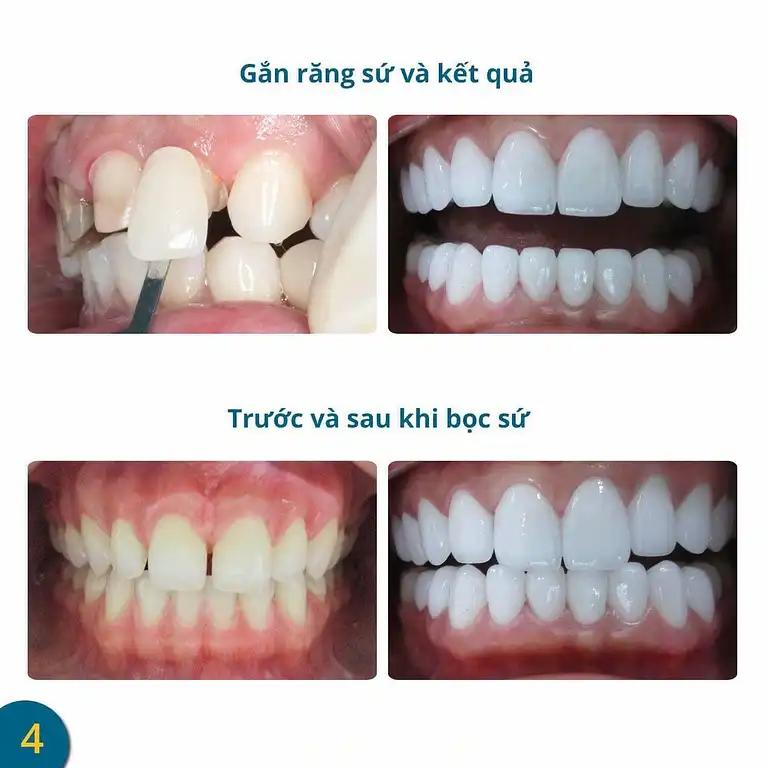 Hình ảnh nha-khoa-thien-duc-duong-so-1-quan-7-tphcm-3