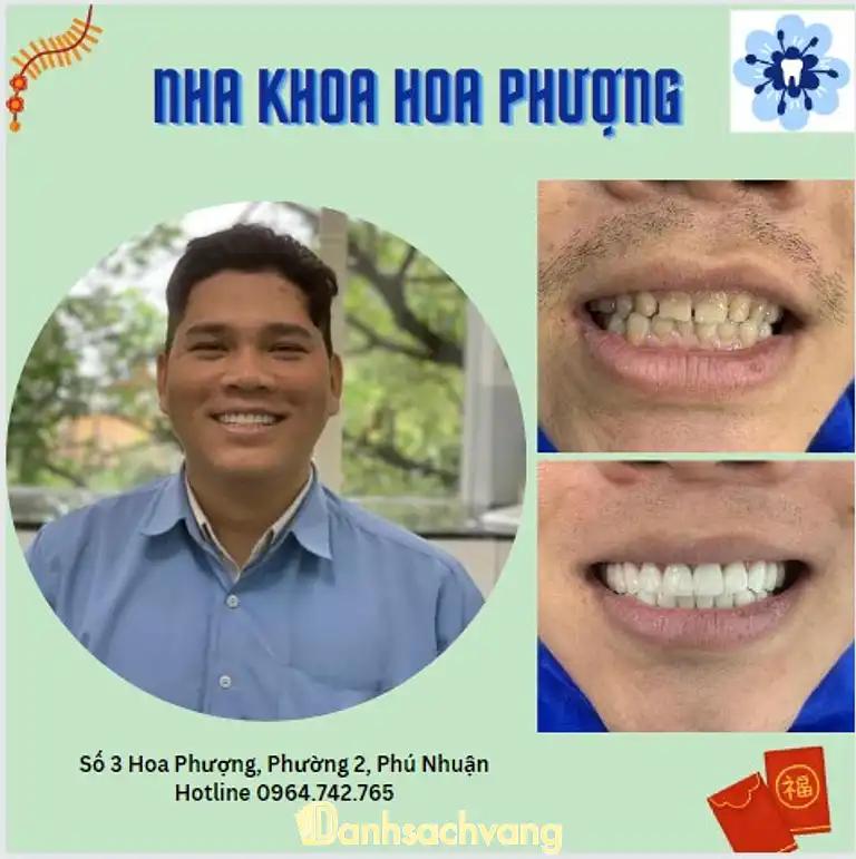 Hình ảnh nha-khoa-hoa-phuong-hoa-phuong-q-phu-nhuan-tphcm-3