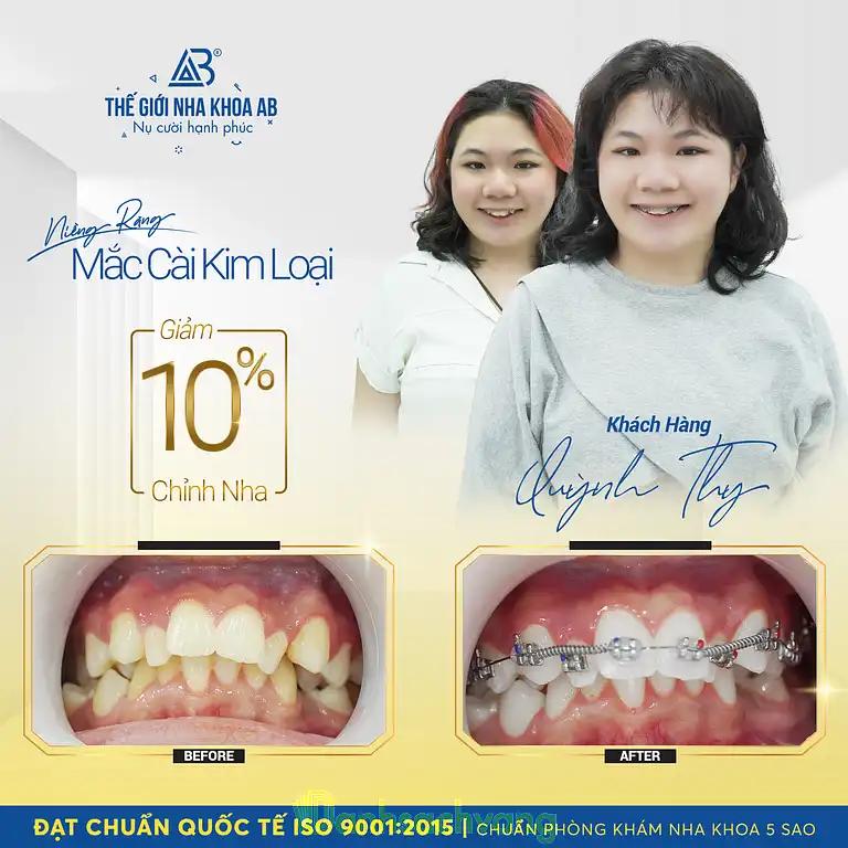 Hình ảnh the-gioi-nha-khoa-ab-khanh-hoi-quan-4-tphcm-3