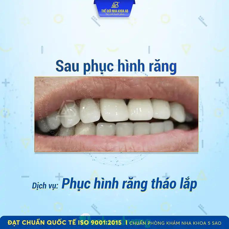 Hình ảnh the-gioi-nha-khoa-ab-cong-hoa-q-tan-binh-tphcm-3