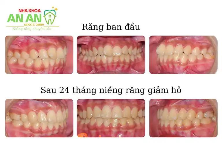 Hình ảnh Nha Khoa An An: 2U Nguyễn Thị Tần, Quận 8