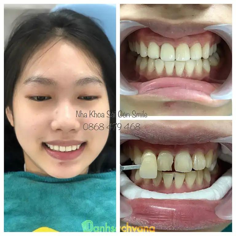Hình ảnh nha-khoa-sai-gon-smile-song-hanh-quan-12-tphcm-3