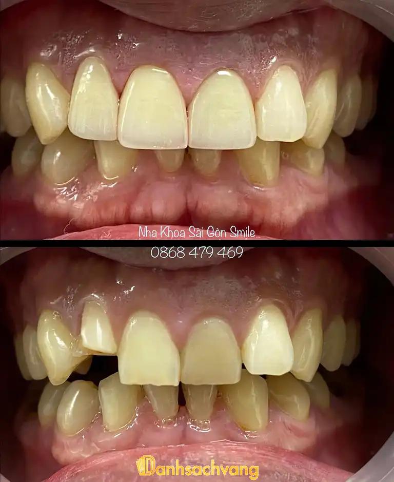Hình ảnh nha-khoa-sai-gon-smile-song-hanh-quan-12-tphcm-4