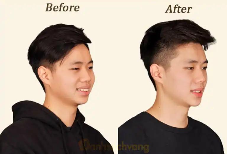 Hình ảnh nha-khoa-viet-phap-ton-that-thuyet-quan-4-tphcm-1