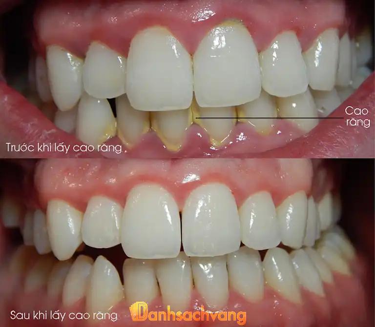 Hình ảnh nha-khoa-viet-phap-ton-that-thuyet-quan-4-tphcm-2